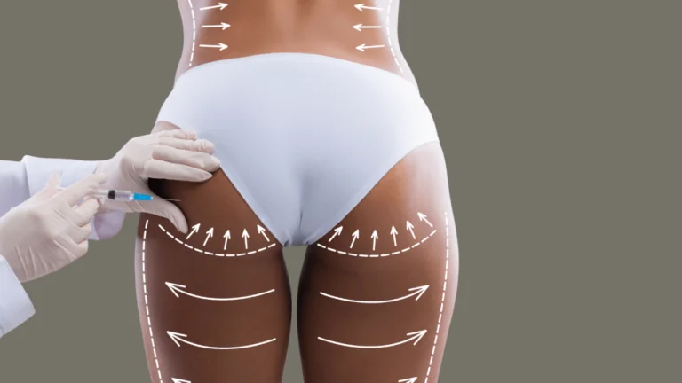 Brazilian Butt Lift