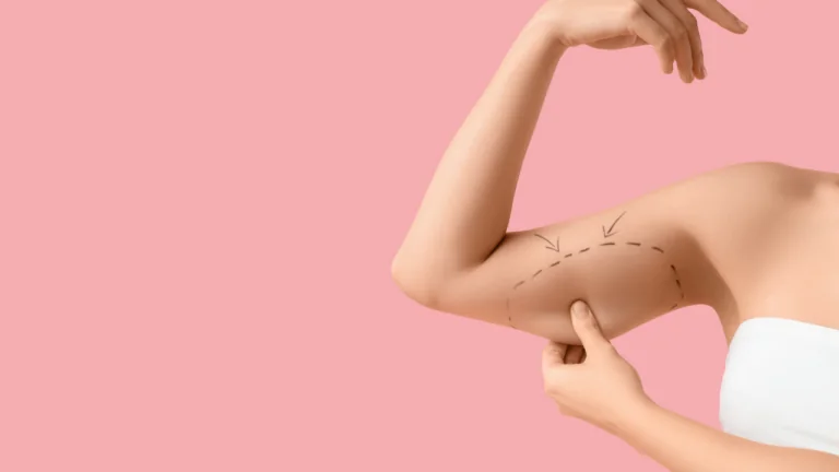 Armlift (Brachioplastik): Lösung gegen schlaffe Arme